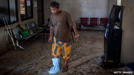 A man with a makeshift plaster on his foot hobbles through a waiting room