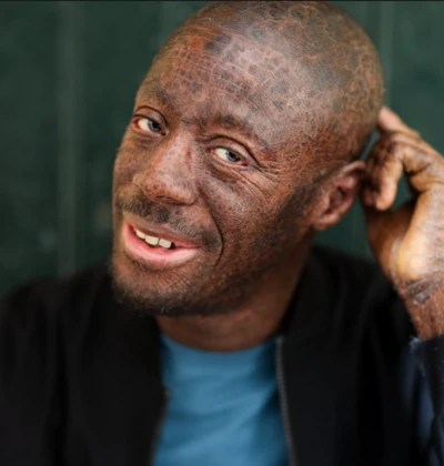 Dockuma, tout souriant, la main sur la tête.
