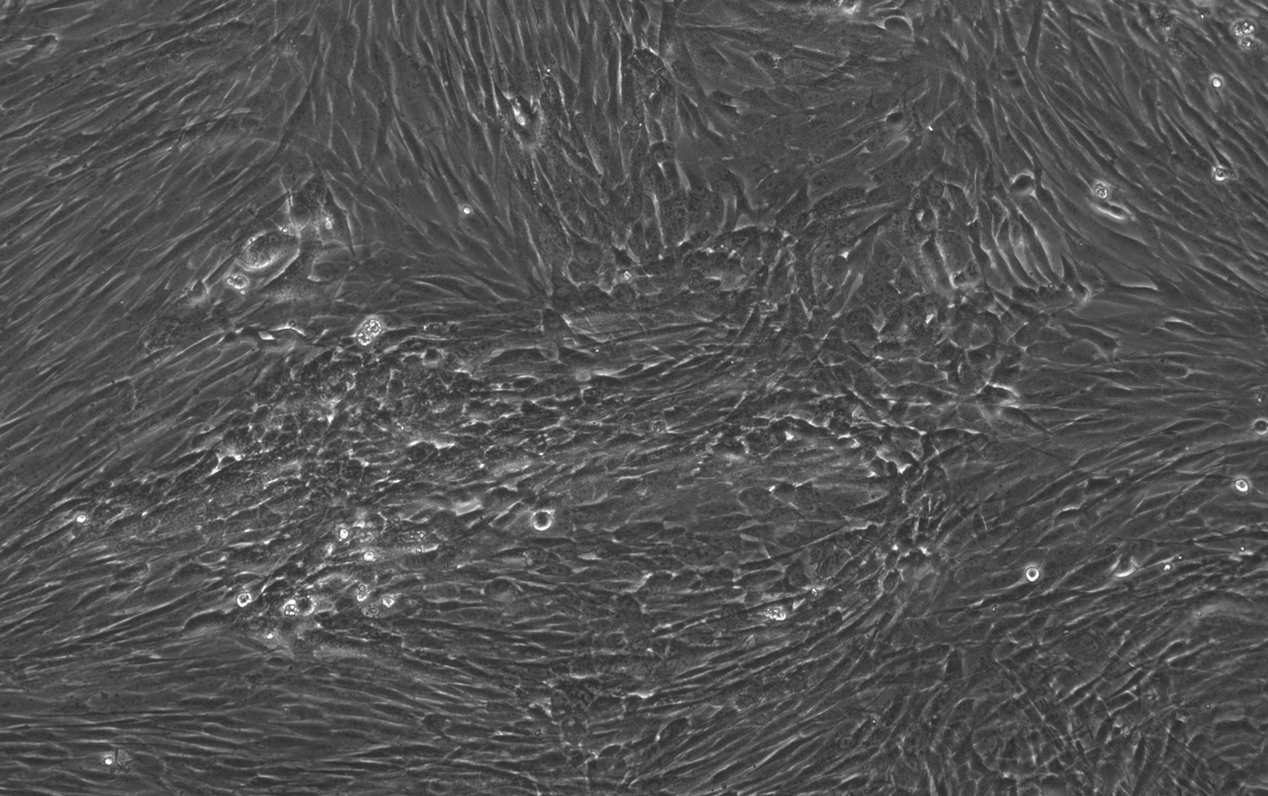 Microscopy image of cells reprogrammed with SOX2, KLF4, OCT4, and MYC at day 10, showing elongated fibroblast-like morphology and clustered cell regions; scale bar indicates 400 µm.